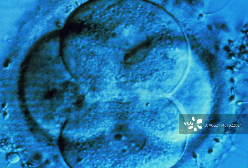 体外受精后四细胞期的人类胚胎的显微镜图像图片素材