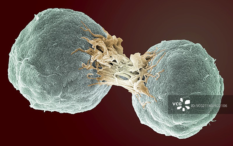 淋巴瘤癌细胞分裂，扫描电子显微镜图片素材