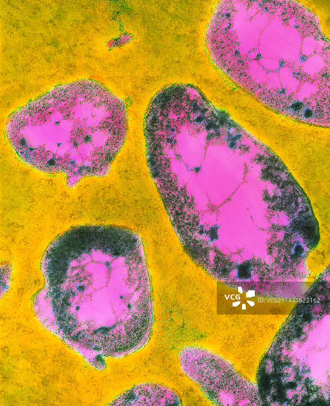 土拉杆菌图片素材