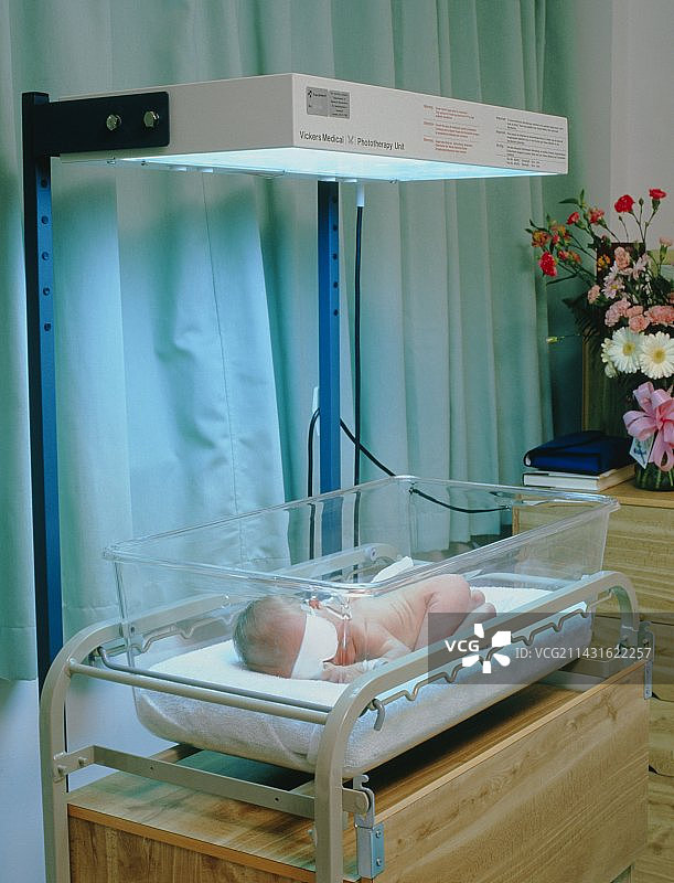 接受光疗的黄疸婴儿图片素材