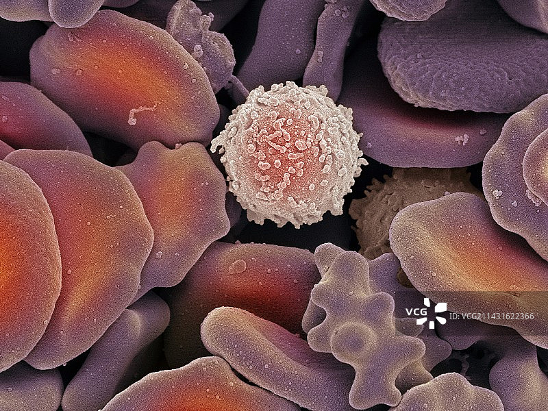血细胞扫描电镜图图片素材