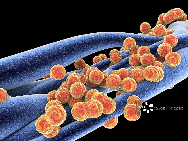 金黄色葡萄球菌耐甲氧西林菌图片素材