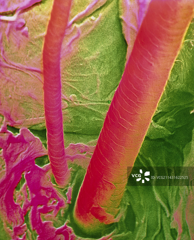 人发和皮肤表面的伪彩色扫描电镜图像图片素材