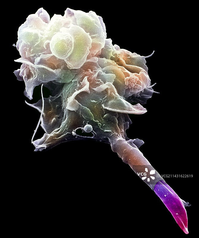 巨噬细胞吞噬利什曼原虫（扫描电镜图像）图片素材