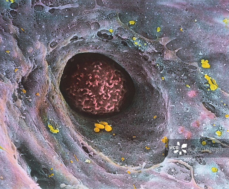 彩色扫描电镜下的血毛细血管中的单核细胞图片素材