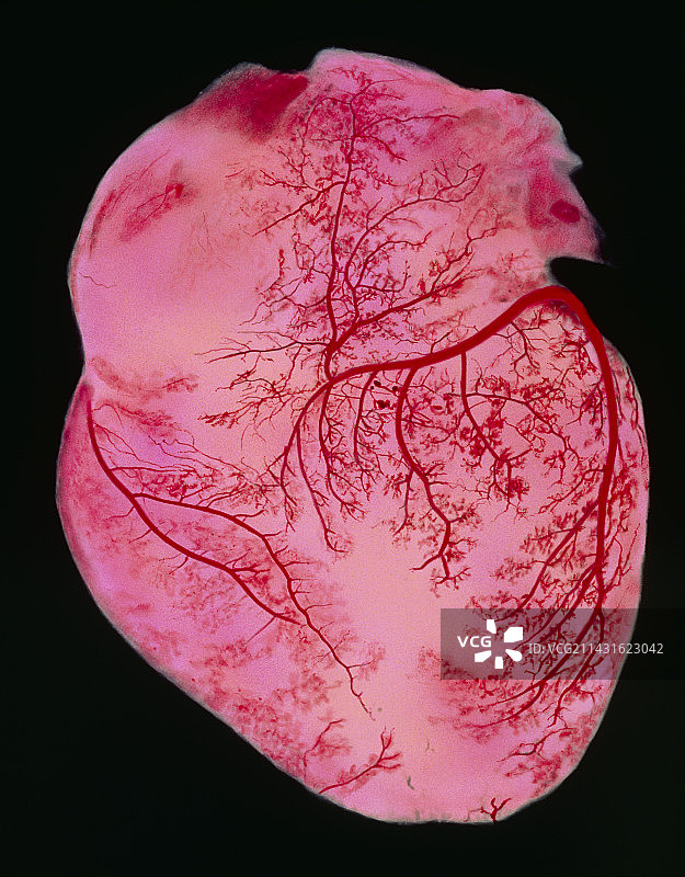 心脏及其血管的彩色图像图片素材