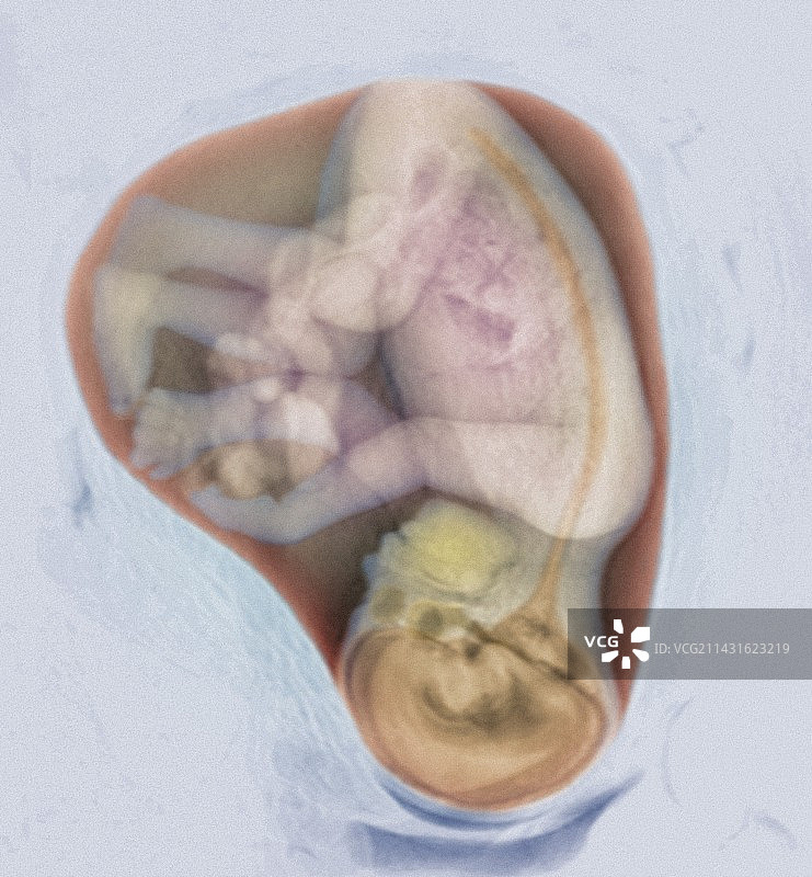 27周胎儿的3D核磁共振扫描图片素材