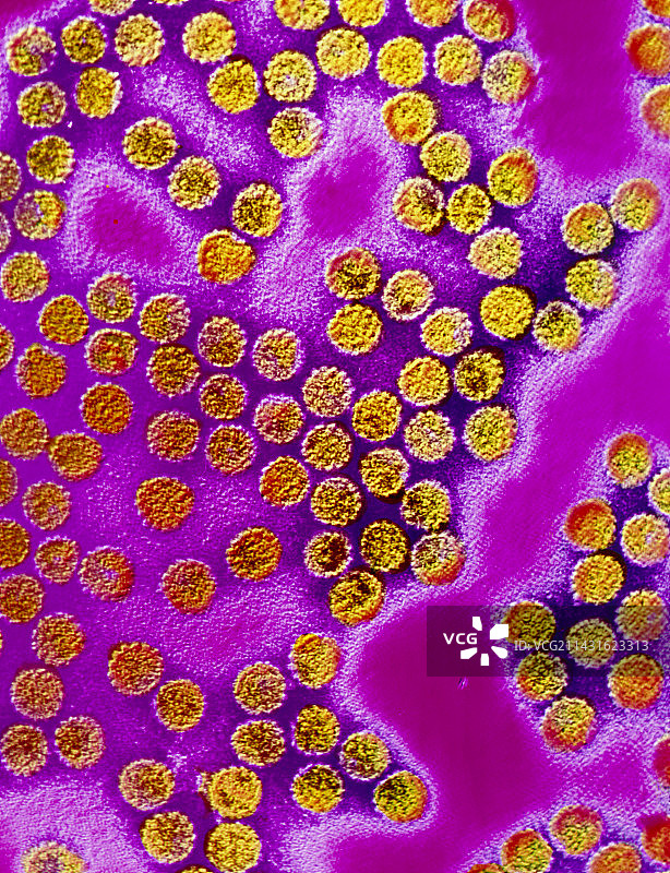 乳头瘤病毒的透射电镜图片素材