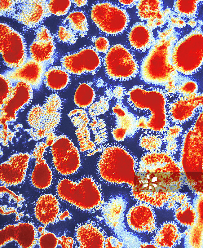 亚洲流感病毒的彩色透射电镜图图片素材