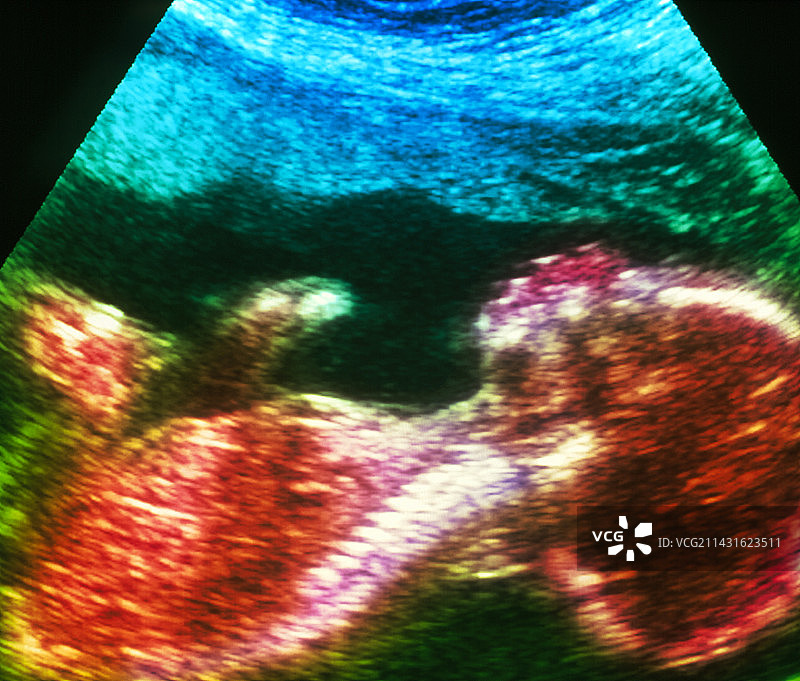 20周大胎儿的超声波扫描（侧视图）图片素材