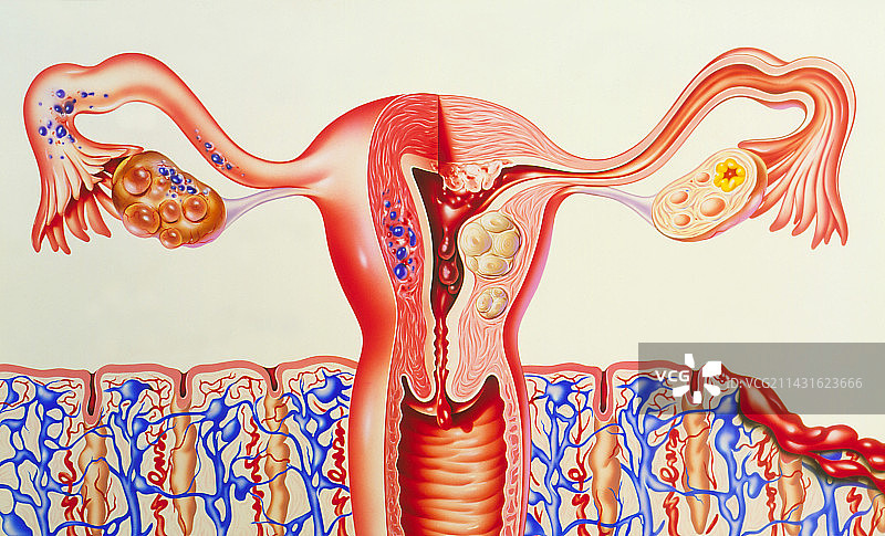 女性生殖系统疾病图片素材