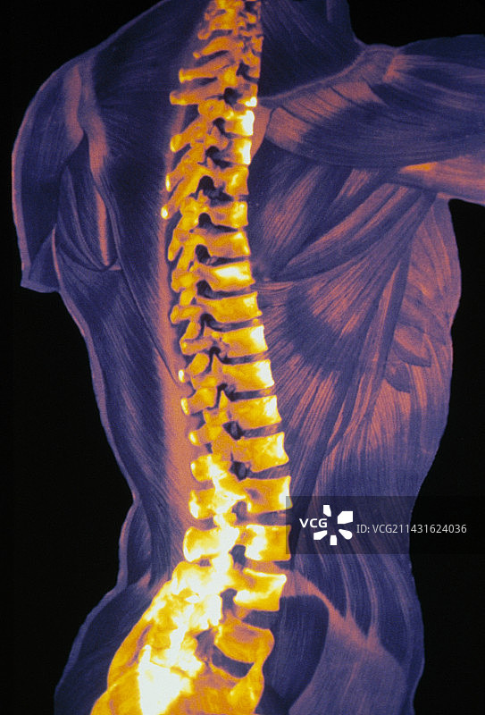 彩色人体脊柱3D CT扫描图片素材