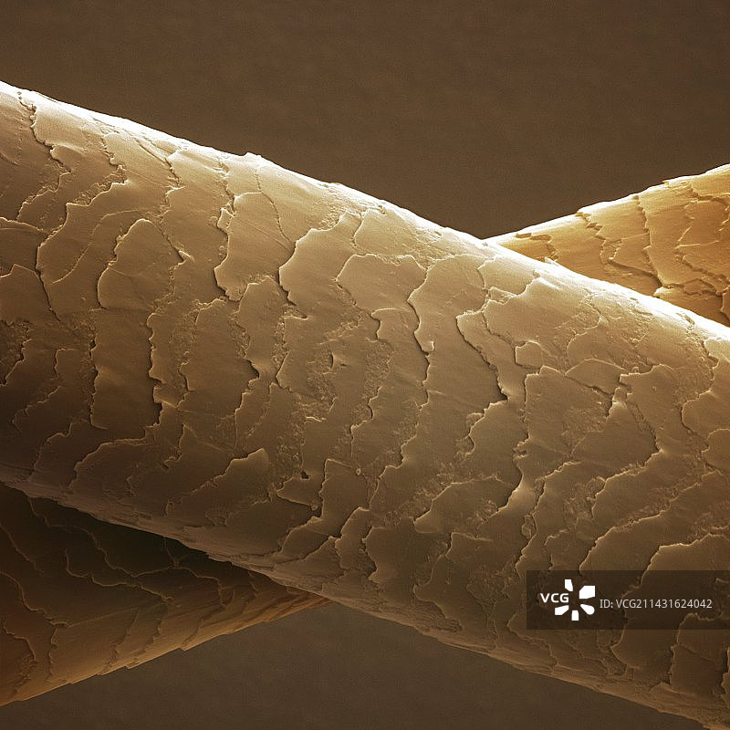 人类头发扫描电镜图图片素材