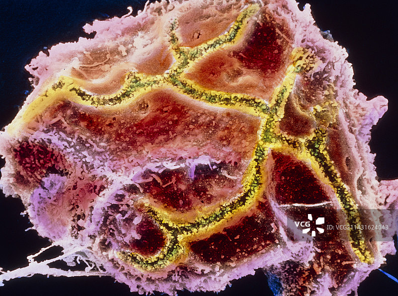 肝细胞彩色扫描电镜图图片素材