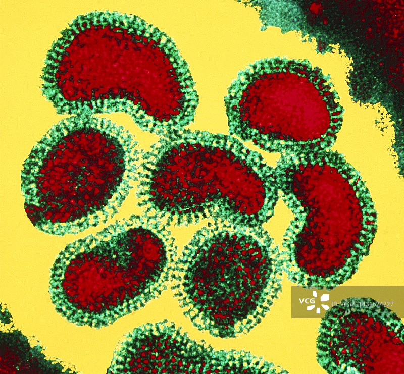 流感病毒簇的彩色透射电镜图图片素材