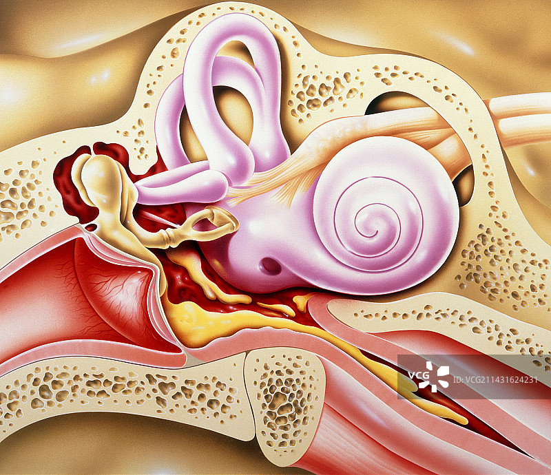 中耳炎图片素材