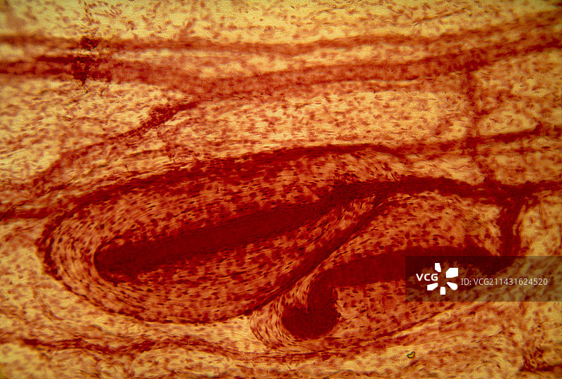 人类皮肤中帕西尼体的LM显微图图片素材