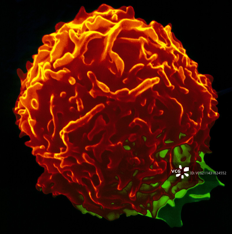 彩色扫描电镜下的人类自然杀伤血细胞图片素材