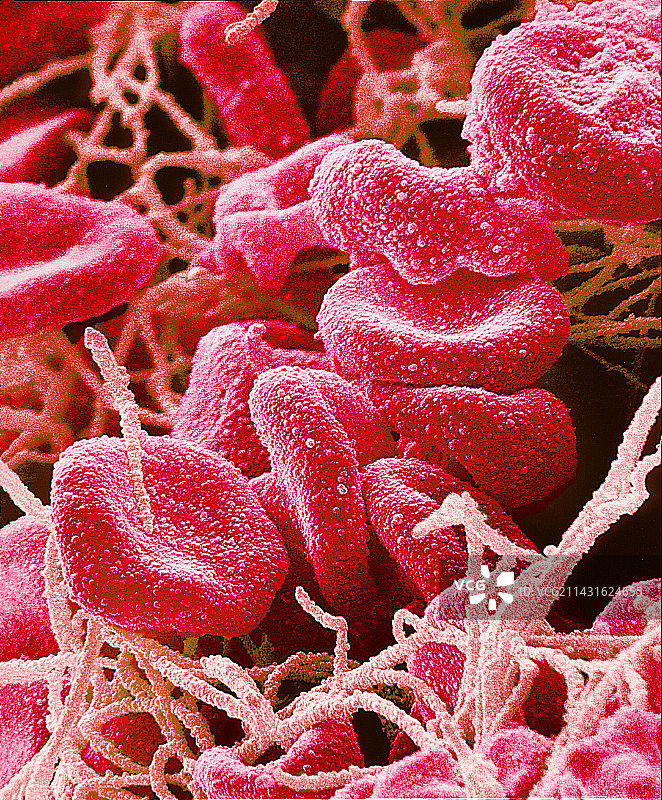 血栓扫描电镜图片素材