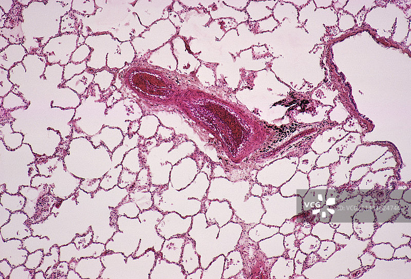 肺泡图片素材