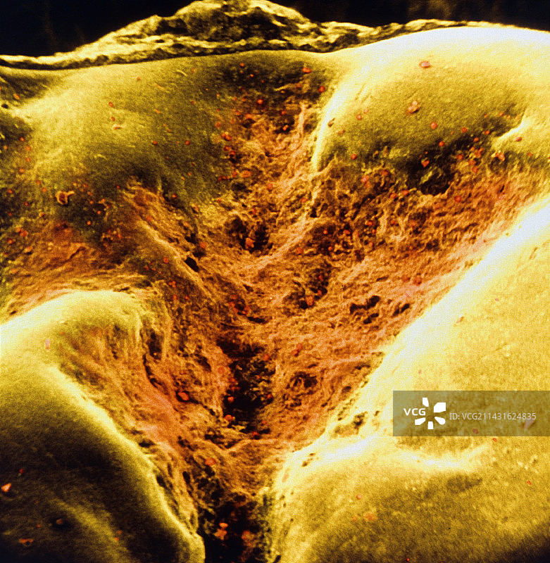 臼齿上食物残渣的电子显微照片图片素材