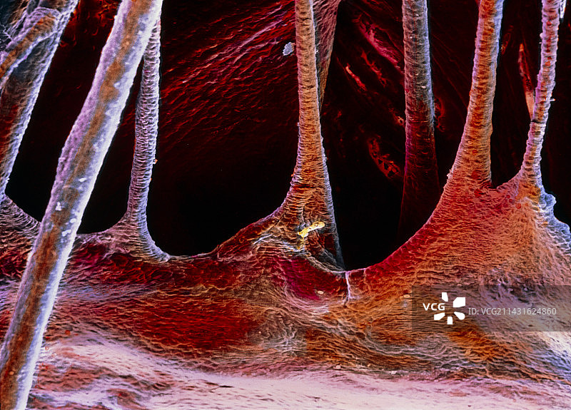 心脏瓣膜部分的假彩色扫描电镜图片素材