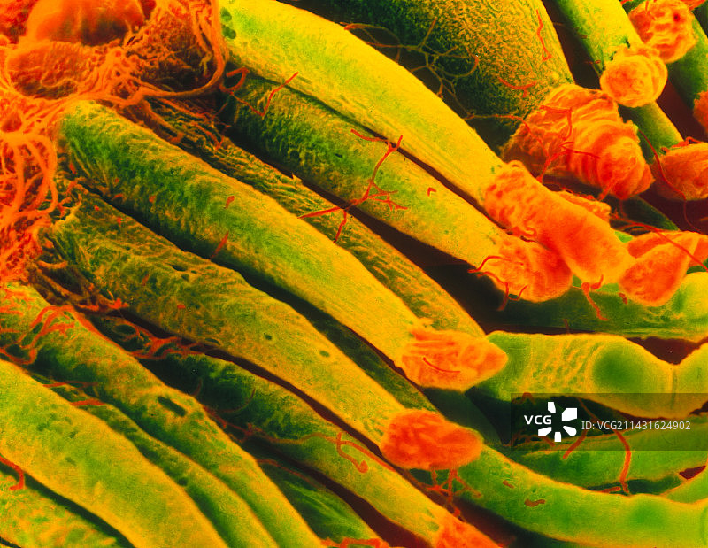 视网膜杆状细胞的彩色扫描电镜图图片素材