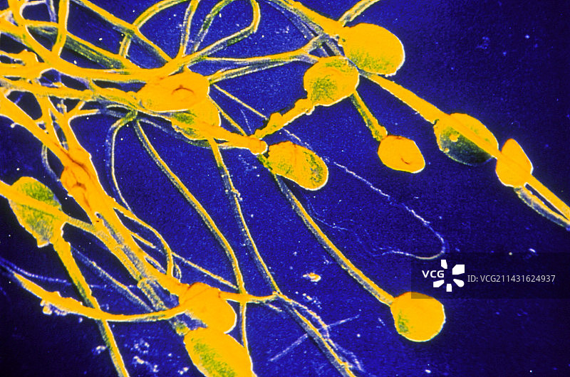 一组人类精子的假彩色扫描电镜图片素材