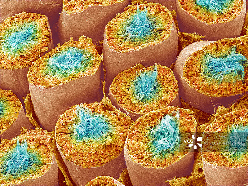 精子产生（扫描电子显微镜图像）图片素材