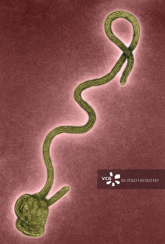 埃博拉病毒TEM图片素材