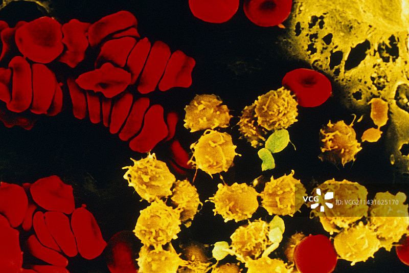 骨髓细胞的彩色扫描电镜图像图片素材