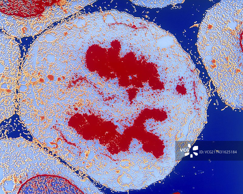 HeLa细胞后期细胞分裂的透射电镜照片图片素材