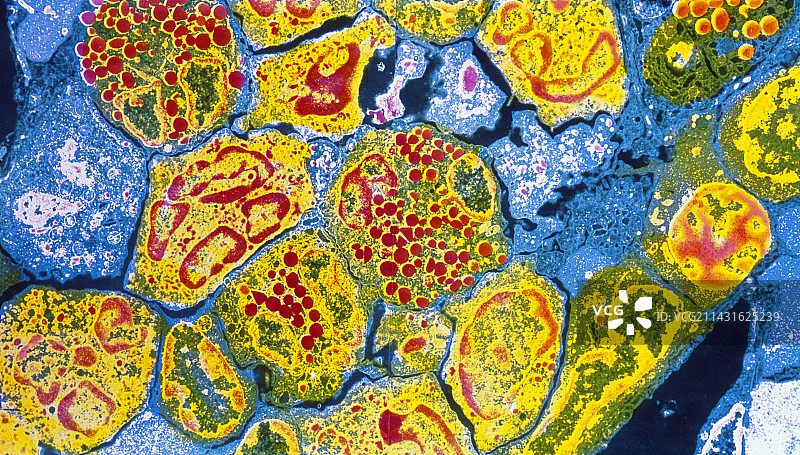 骨髓细胞的彩色透射电镜图图片素材