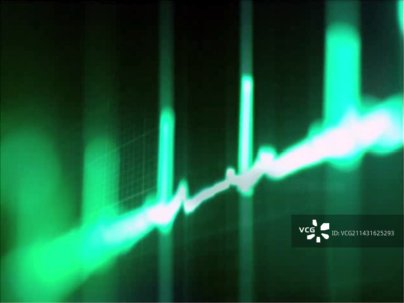 心电图图片素材