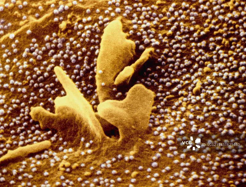 风疹病毒从细胞表面爆发的扫描电镜图像图片素材