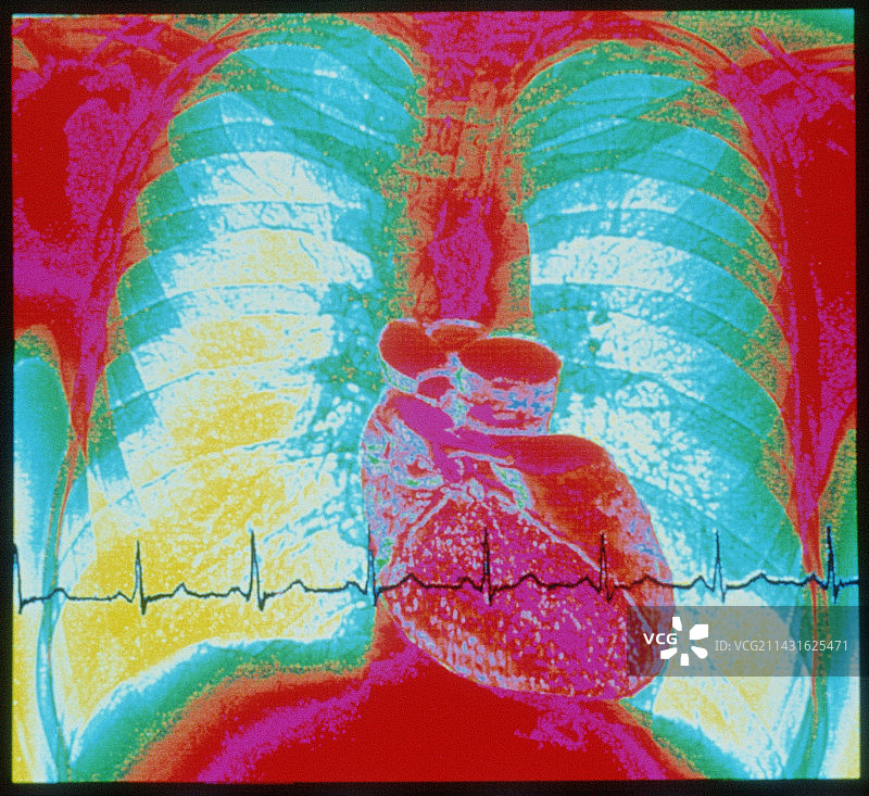 彩色X光胸部和心脏扫描及心电图图片素材