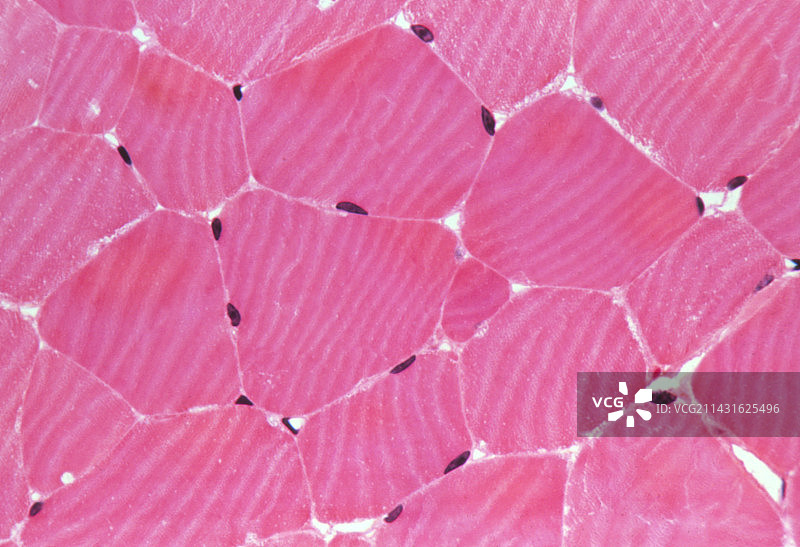 骨骼肌图片素材