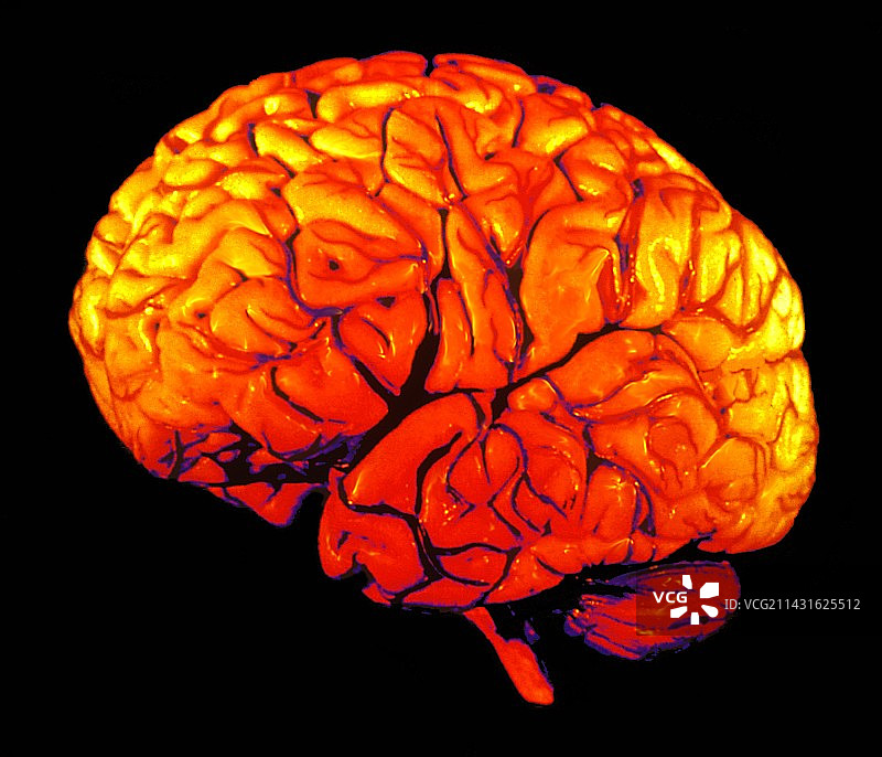 大脑三维核磁共振扫描图片素材