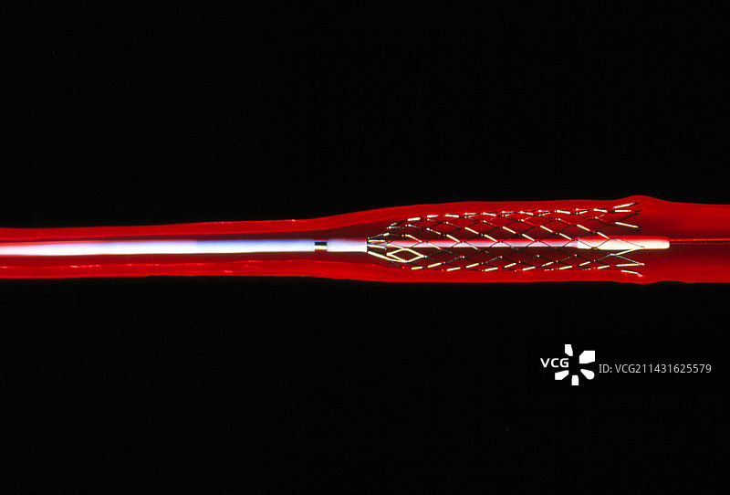 动脉中的冠状动脉支架模型图片素材