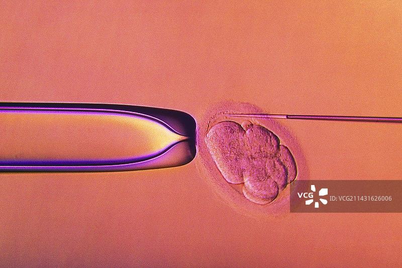 试管婴儿胚胎检测图片素材