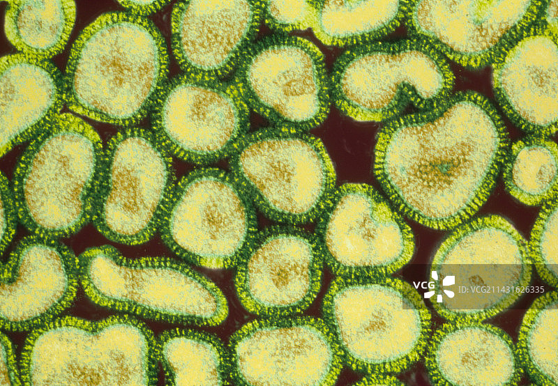 流感病毒的彩色透射电子显微镜图像图片素材