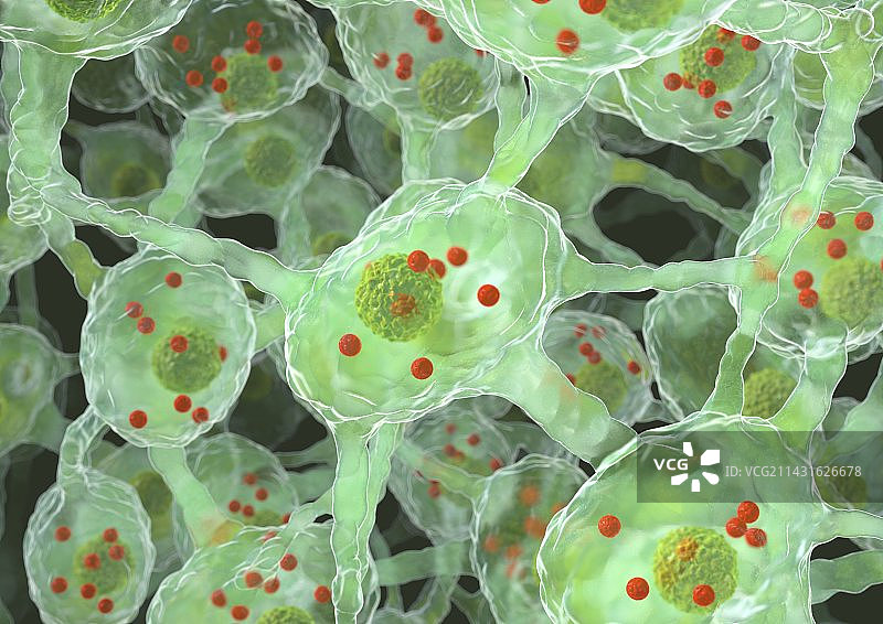 帕金森病神经细胞，艺术作品图片素材