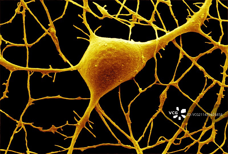 浦肯野神经细胞扫描电镜图图片素材