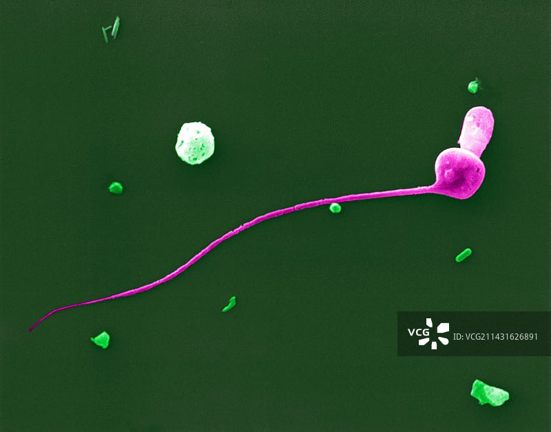 彩色扫描电镜下的畸形精子图片素材