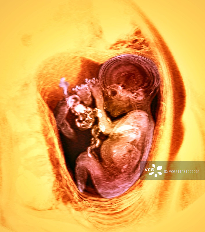 9个月胎儿核磁共振扫描图片素材