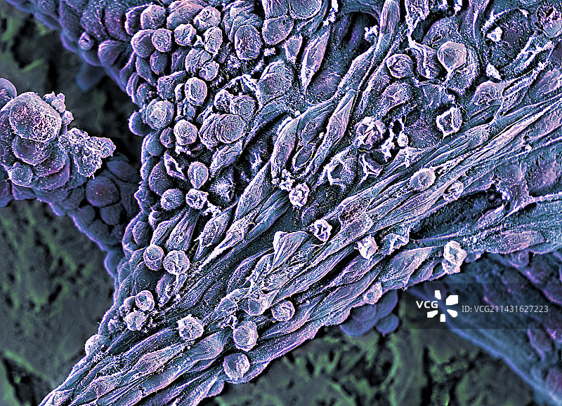 人类胚胎干细胞扫描电镜图图片素材