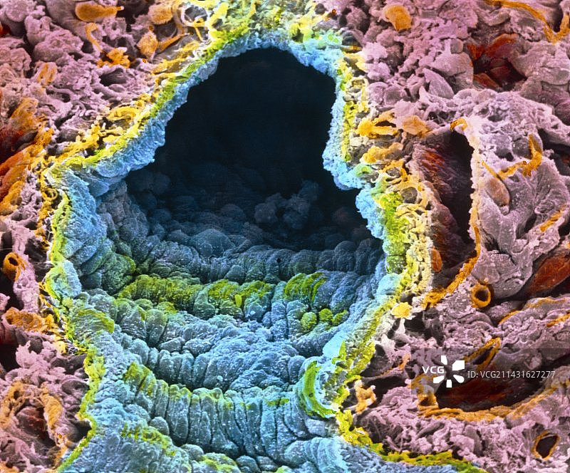 显示肺泡和血管的肺部彩色扫描电镜图像图片素材