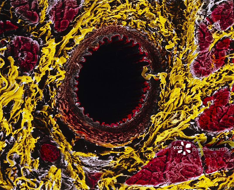 舌组织动脉彩色扫描电镜图图片素材