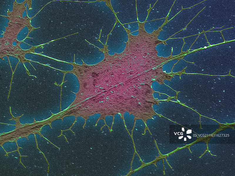 神经细胞培养扫描电镜图图片素材