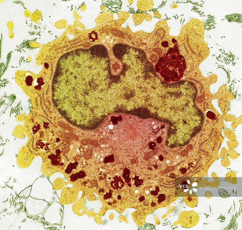巨噬细胞透射电镜图图片素材